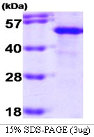 ST13 Protein