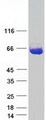 ST13 Protein - Purified recombinant protein ST13 was analyzed by SDS-PAGE gel and Coomassie Blue Staining