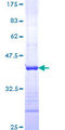 ST14 / Matriptase Protein - 12.5% SDS-PAGE Stained with Coomassie Blue.