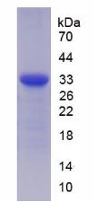 ST14 / Matriptase Protein - Recombinant Suppression Of Tumorigenicity 14 By SDS-PAGE