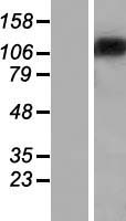 ST18 Protein - Western validation with an anti-DDK antibody * L: Control HEK293 lysate R: Over-expression lysate