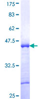 ST18 Protein - 12.5% SDS-PAGE Stained with Coomassie Blue.