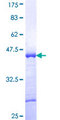 ST18 Protein - 12.5% SDS-PAGE Stained with Coomassie Blue.