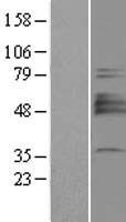 ST3GAL1 Protein - Western validation with an anti-DDK antibody * L: Control HEK293 lysate R: Over-expression lysate