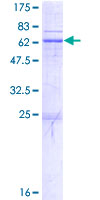 ST3GAL1 Protein - 12.5% SDS-PAGE of human ST3GAL1 stained with Coomassie Blue