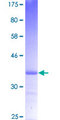 ST3GAL1 Protein - 12.5% SDS-PAGE Stained with Coomassie Blue.