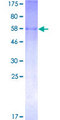 ST3GAL2 Protein - 12.5% SDS-PAGE of human ST3GAL2 stained with Coomassie Blue