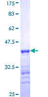 ST3GAL2 Protein - 12.5% SDS-PAGE Stained with Coomassie Blue.