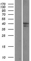 ST3GAL3 / ST3N Protein - Western validation with an anti-DDK antibody * L: Control HEK293 lysate R: Over-expression lysate
