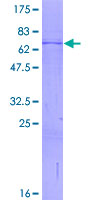 ST3GAL3 / ST3N Protein - 12.5% SDS-PAGE of human ST3GAL3 stained with Coomassie Blue