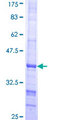 ST3GAL3 / ST3N Protein - 12.5% SDS-PAGE Stained with Coomassie Blue.