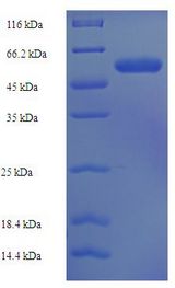 ST3GAL3 / ST3N Protein