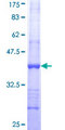 ST3GAL4 / ST3Gal IV Protein - 12.5% SDS-PAGE Stained with Coomassie Blue.