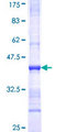 ST3GAL5 / GM3 Synthase Protein - 12.5% SDS-PAGE Stained with Coomassie Blue.
