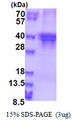ST3GAL5 / GM3 Synthase Protein