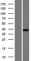 ST3GAL6 Protein - Western validation with an anti-DDK antibody * L: Control HEK293 lysate R: Over-expression lysate