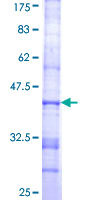 ST3GAL6 Protein - 12.5% SDS-PAGE Stained with Coomassie Blue.