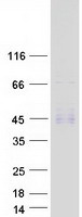 ST3GAL6 Protein - Purified recombinant protein ST3GAL6 was analyzed by SDS-PAGE gel and Coomassie Blue Staining