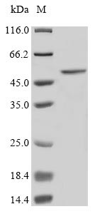 ST6GAL1 / CD75 Protein - (Tris-Glycine gel) Discontinuous SDS-PAGE (reduced) with 5% enrichment gel and 15% separation gel.
