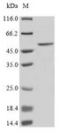 ST6GAL1 / CD75 Protein - (Tris-Glycine gel) Discontinuous SDS-PAGE (reduced) with 5% enrichment gel and 15% separation gel.