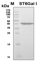 ST6GAL1 / CD75 Protein