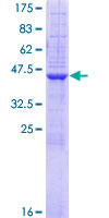 ST6GAL1 / CD75 Protein - 12.5% SDS-PAGE of human ST6GAL1 stained with Coomassie Blue