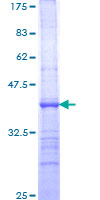 ST6GAL1 / CD75 Protein - 12.5% SDS-PAGE Stained with Coomassie Blue.