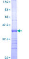 ST6GAL1 / CD75 Protein - 12.5% SDS-PAGE Stained with Coomassie Blue.
