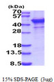 ST6GAL1 / CD75 Protein