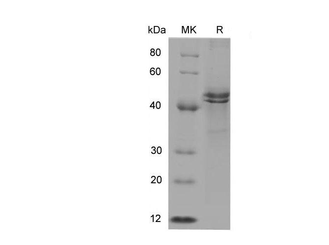 ST6GAL1 / CD75 Protein - Recombinant Human CD75/ST6GAL1 Protein (His Tag)
