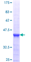 ST6GAL2 Protein - 12.5% SDS-PAGE Stained with Coomassie Blue.