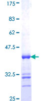 ST6GALNAC1 Protein - 12.5% SDS-PAGE Stained with Coomassie Blue