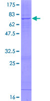 ST6GALNAC2 Protein - 12.5% SDS-PAGE of human ST6GALNAC2 stained with Coomassie Blue