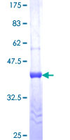ST6GALNAC2 Protein - 12.5% SDS-PAGE Stained with Coomassie Blue.