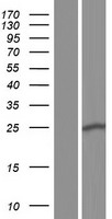 ST6GALNAC3 Protein - Western validation with an anti-DDK antibody * L: Control HEK293 lysate R: Over-expression lysate