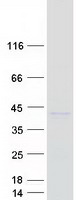 ST6GALNAC3 Protein - Purified recombinant protein ST6GALNAC3 was analyzed by SDS-PAGE gel and Coomassie Blue Staining