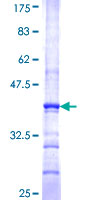 ST6GALNAC4 Protein - 12.5% SDS-PAGE Stained with Coomassie Blue.