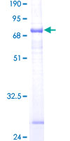 ST6GALNAC6 Protein - 12.5% SDS-PAGE of human ST6GALNAC6 stained with Coomassie Blue