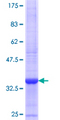 ST6GALNAC6 Protein - 12.5% SDS-PAGE Stained with Coomassie Blue.