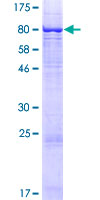ST7 Protein - 12.5% SDS-PAGE of human ST7 stained with Coomassie Blue