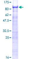 ST7L Protein - 12.5% SDS-PAGE of human ST7L stained with Coomassie Blue