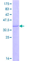 ST8SIA1 Protein - 12.5% SDS-PAGE Stained with Coomassie Blue.