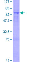 ST8SIA2 / STX Protein - 12.5% SDS-PAGE of human ST8SIA2 stained with Coomassie Blue