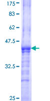 ST8SIA2 / STX Protein - 12.5% SDS-PAGE Stained with Coomassie Blue.