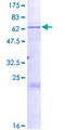 ST8SIA3 Protein - 12.5% SDS-PAGE of human ST8SIA3 stained with Coomassie Blue