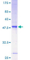 ST8SIA4 Protein - 12.5% SDS-PAGE of human ST8SIA4 stained with Coomassie Blue