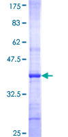 ST8SIA5 Protein - 12.5% SDS-PAGE Stained with Coomassie Blue.