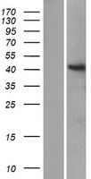 ST8SIA6 Protein - Western validation with an anti-DDK antibody * L: Control HEK293 lysate R: Over-expression lysate