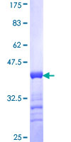 STAB1 Protein - 12.5% SDS-PAGE Stained with Coomassie Blue.