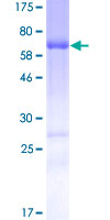 STAC Protein - 12.5% SDS-PAGE of human STAC stained with Coomassie Blue